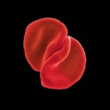 Win Peter Gabriel �Scratch My Back� CDs